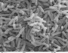 Microscopic view of cholera bacteria.